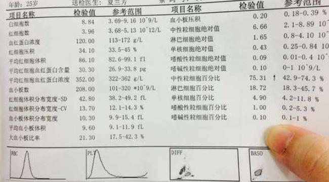 唐筛数据怎么看性别