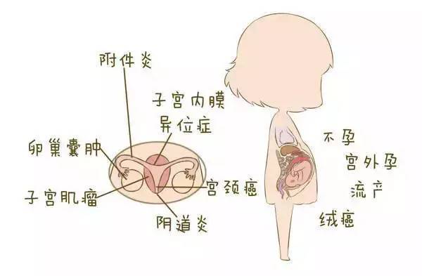 妇科疾病怀孕几率高不高.jpg