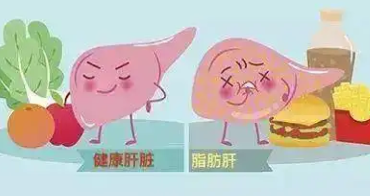 孕期怀孕脂肪肝叫什么疾病.png