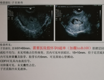 验血查怀孕最早几天可以查出来.png