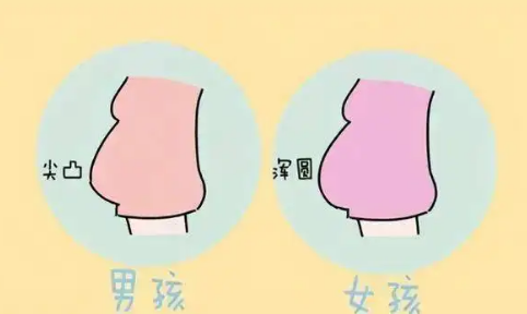 什么样的肚子是男宝还是女宝.png