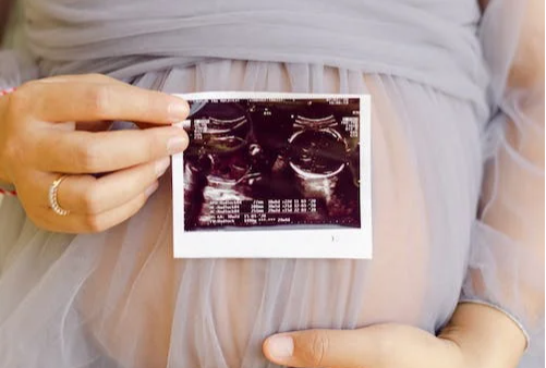 孕初期怎样判断怀的是男孩还是女孩.png