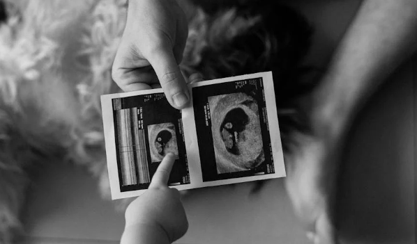 香港胎儿YDNA检测预约后上门采血范围包含哪些.png 香港胎儿YDNA检测预约后上门采血范围包含哪些.png