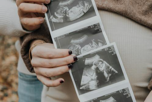 贵州怎么直接去香港YDNA检测验血检查性别.png 贵州怎么直接去香港YDNA检测验血检查性别.png